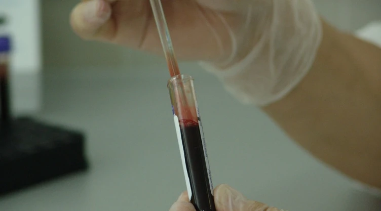 Científicos descubren nuevo mecanismo que impide incremento de células cancerosas