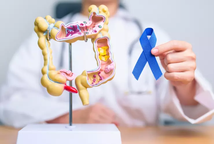 Cáncer de colon tiene nuevo tratamiento