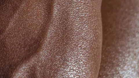 Estos síntomas indican que tu piel está deshidratada