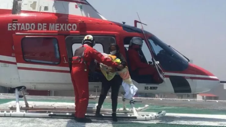 TRASLADO BEBÉ CON QUEMADURAS.jpeg