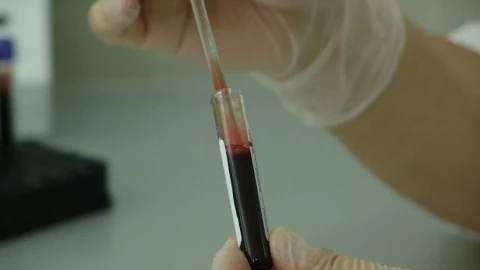 vih paciente tratamiento