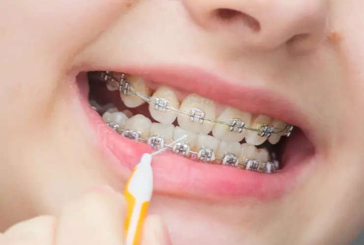 precio brackets México 2025