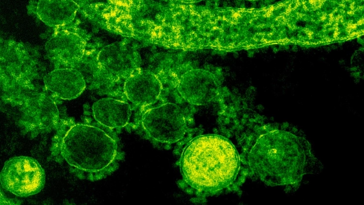 Metapneumovirus-humano-hmpv-reportan-muerte-de-paciente-en-Puebla