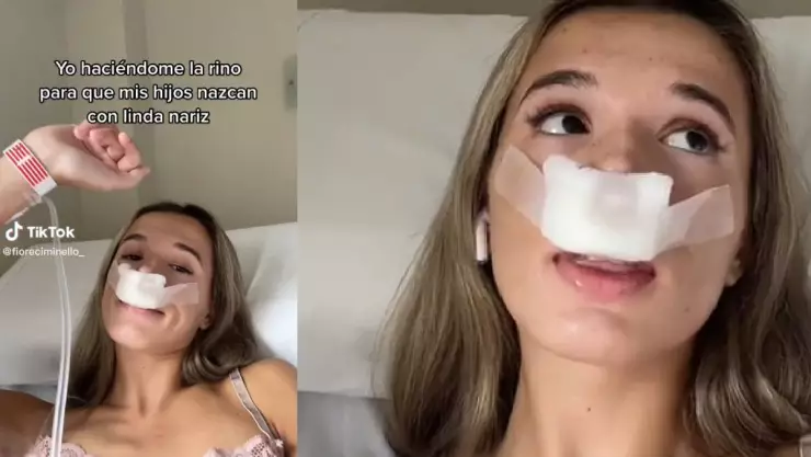 Joven se hace rinoplastía para que hijos tengan nariz linda