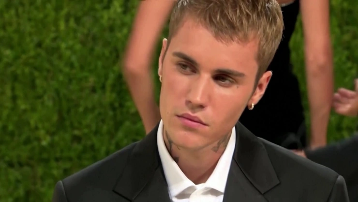 Justin Bieber se recupera tras parálisis facial por síndrome de Ramsay.