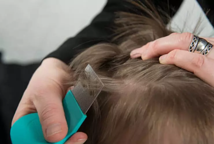 ¡No te lo imaginas! Este es el SIGNIFICADO de soñar con piojos en la cabeza