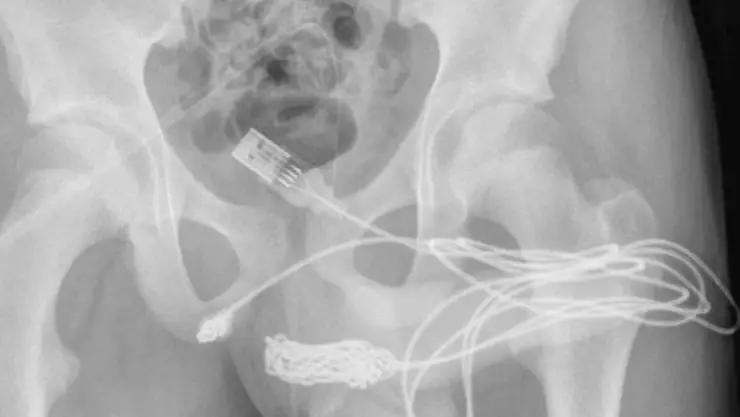 Se mete cable USB por el pene.jpg