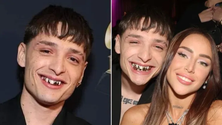 Peso Pluma estrena nueva dentadura de oro en los Grammy 2024