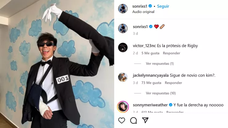 VIDEO | ¿FALSO? Sonrixs responde a las acusaciones sobre su fractura de brazo