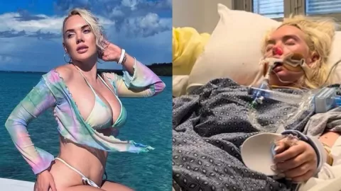 Jennifer Barlow Modelo estadounidense contrae bacteria carnívora; le amputan pierna