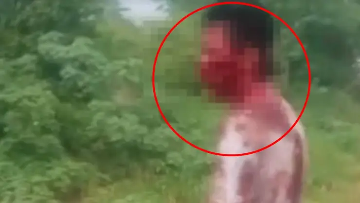 hombre herido en tapachula