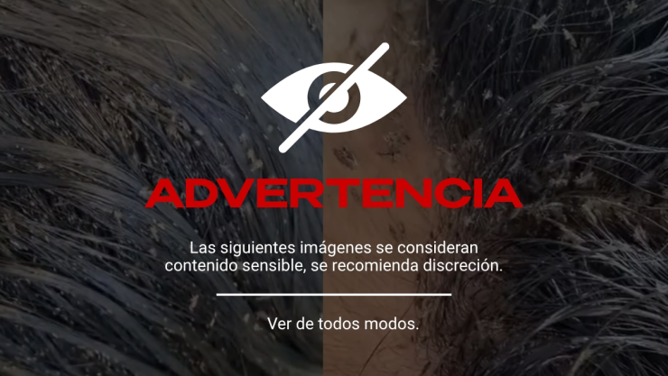Menor muere por infestación de piojos