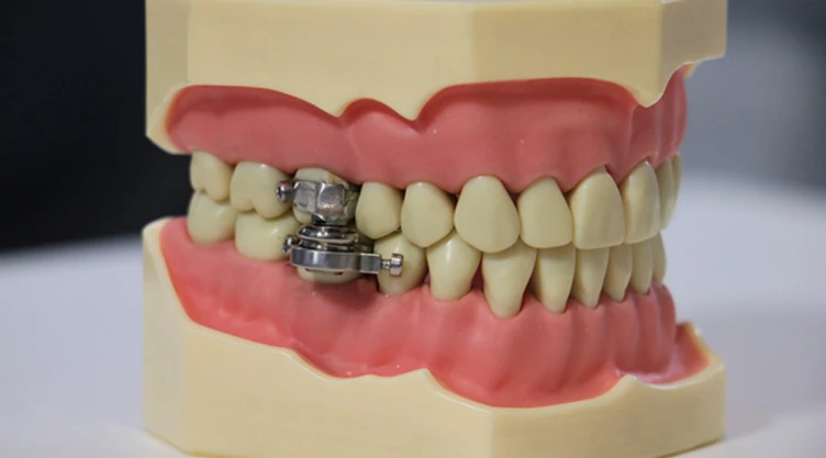 candado-dientes.jpg