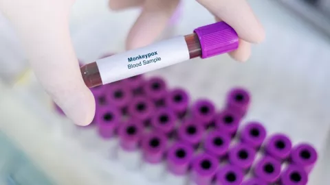 Qué significa que la cepa de viruela del mono tenga “potencial pandémico”