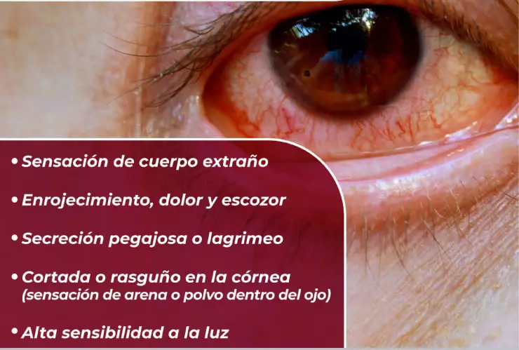 Principales efectos de irritaci&oacute;n por ceniza del Popocat&eacute;petl