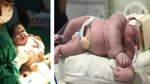 Bebé gigante en Brasil