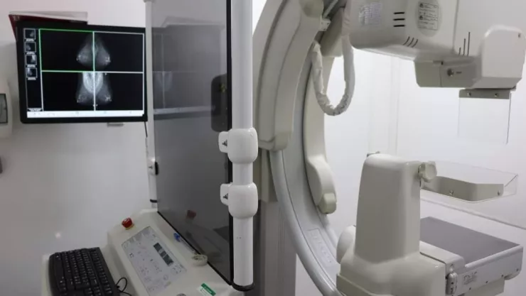 Fechas y horarios de las mastografías gratuitas en la alcaldía CDMX