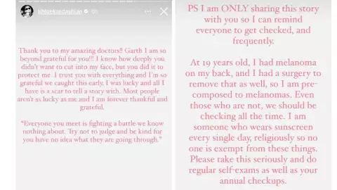 tumor en el rostro de Khloé kardashian