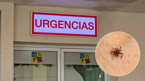 Rickettsia en Sinaloa