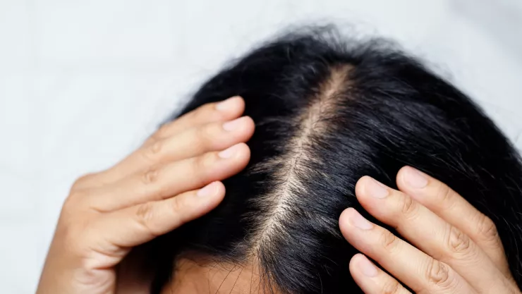 Este es el hábito que frena la caída del cabello: ¡Hazlo 3 veces a la semana!