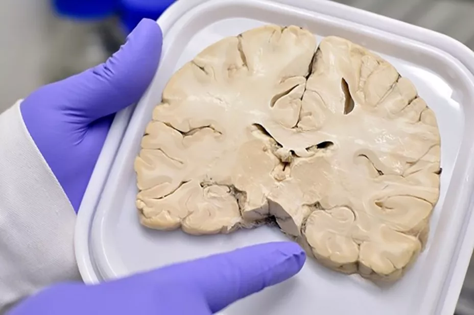 Banco de cerebros_UNAM-DGCS.jpg