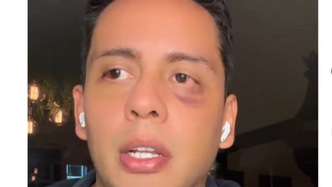 Fan de Shakira podría perder la vista tras ser agredido en concierto en México