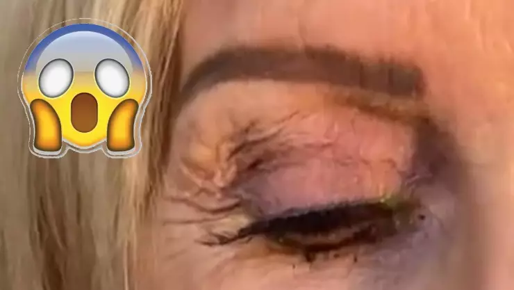 Le sacan 23 lentes de contacto a una mujer