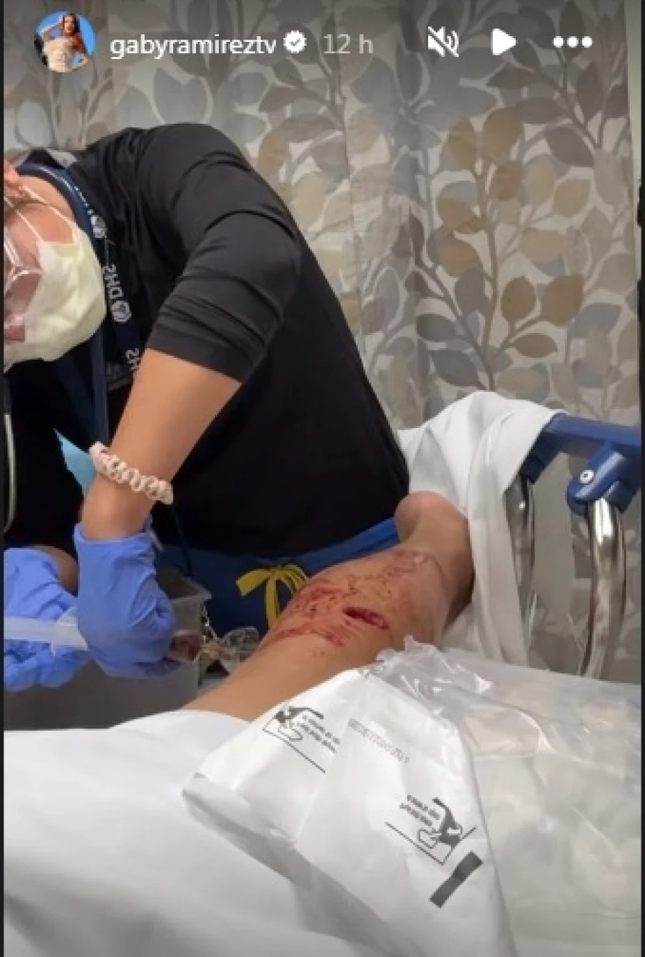 Gaby Ramírez preocupa a sus seguidores tras ser atacada por un perro (1).jpg