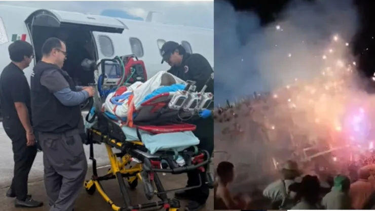 Estado de salud de la Ximena, niña con quemaduras tras explosión de pirotecnia en Temascalcingo, Edomex