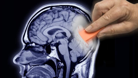 La información olvidada permanece intacta en el cerebro