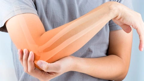 Osteoporosis en jovenes