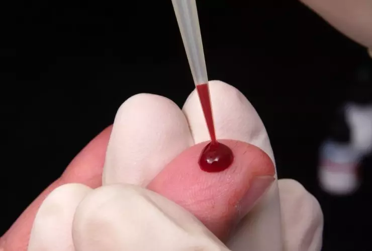 Plasma niños anticuerpos 2.jpg