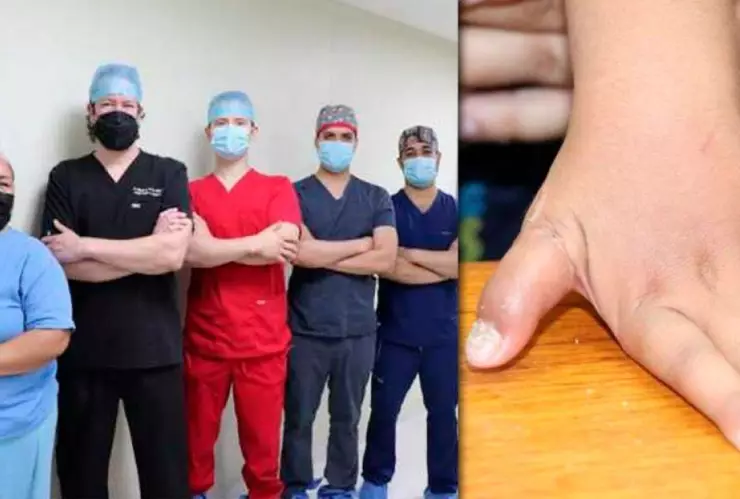 Cirujanos reimplante dedo