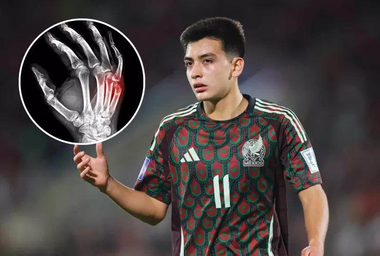 La lesión de Gilberto Mora, según la ciencia