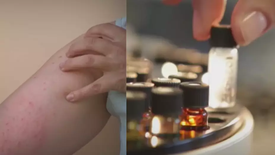 Sarampión en México regresa por la baja cobertura de vacunación