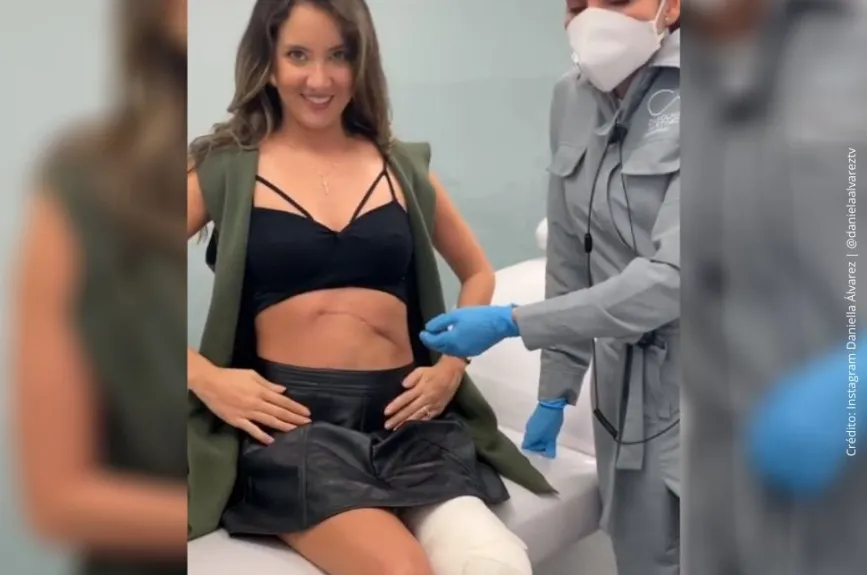 Daniela Álvarez amputada..jpg
