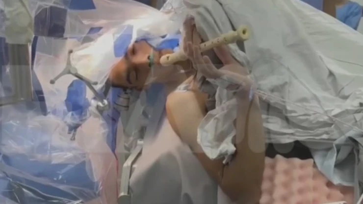 Joven músico se sometió a una cirugía cerebral mientras tocaba la flauta.