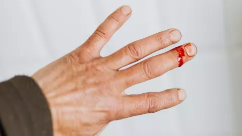 A través de una simple herida abierte puede entrar la temida ‘bacteria come carne’ a nuestro cuerpo