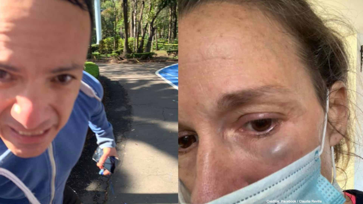 hombre golpea mujer parque hundido.jpg