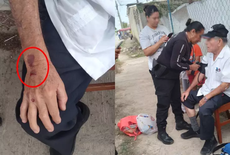 Abuelito sufre accidente en transporte público de Mérida; chófer se dio a la fuga