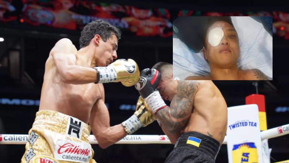 divino espinoza arnold khegai lesion ojo