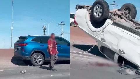 Accidente deja a un hombre sin la mitad del rostro