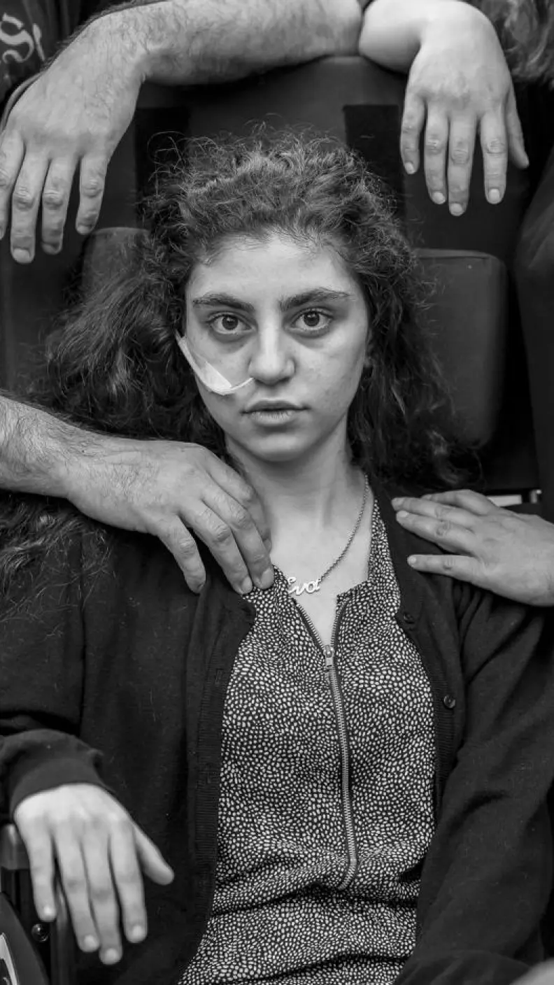 Joven armenia se recupera del Síndrome de Resignación, un síndrome disociativo que induce un estado catatónico