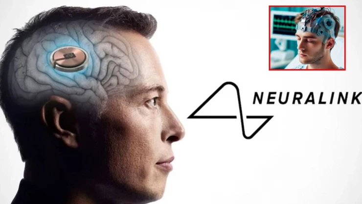 Chip cerebral en humanos