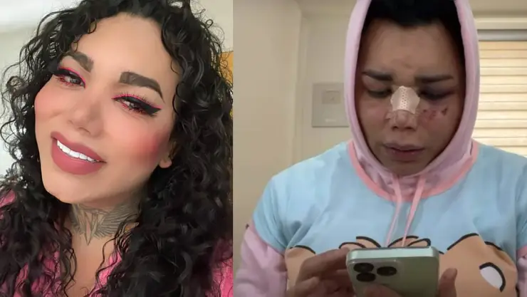 VIDEO_ Paola Suárez confiesa seguir queriendo a su prometido pese a la golpiza que le dio