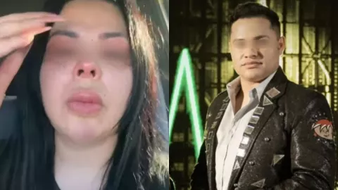 VIDEO | Así lucen las heridas de Fernanda Redondo tras acusar a vocalista de Los Recoditos de presunto abuso físico