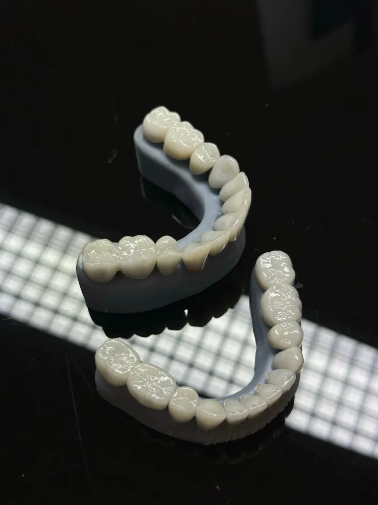 El significado de soñar que se me caen los dientes