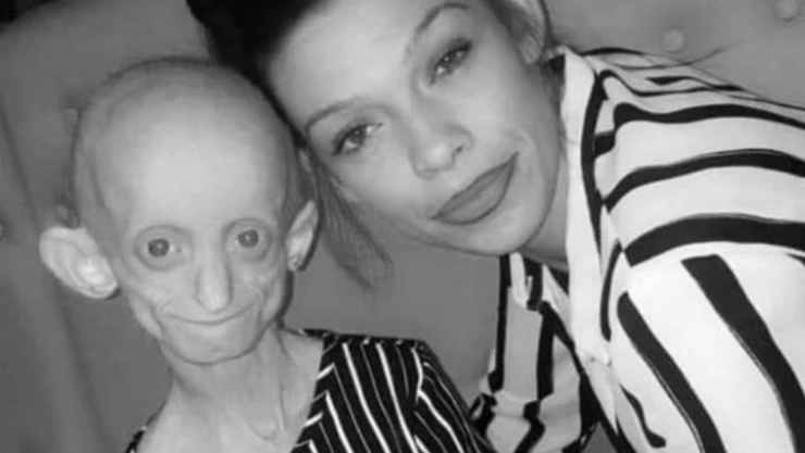 enfermedades_raras_mexico_mundo