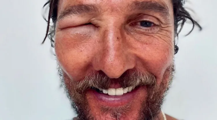 Matthew McConaughey