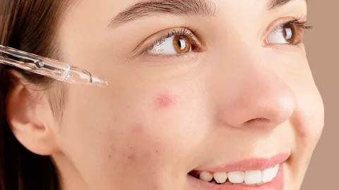 La técnica correcta para ocultar granos con maquillaje